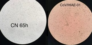 coronavírus laboratório