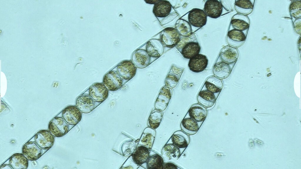 microplásticos em algas microscópio