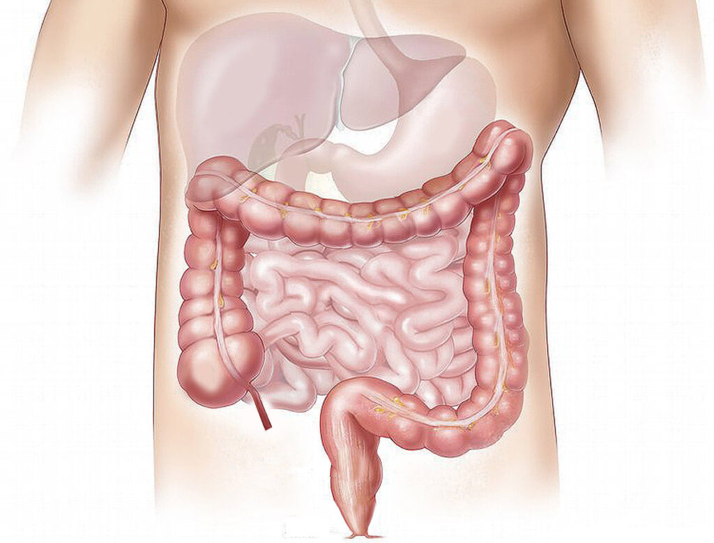 intestino